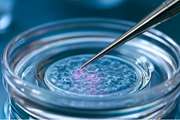 ‏World’s First Clinical Trial Using Embryonic Stem Cells to Treat Huntington’s Disease Launches