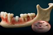 Researchers at Kyoto University Hospital in Japan are testing a groundbreaking treatment that could allow humans to naturally regrow missing teeth.