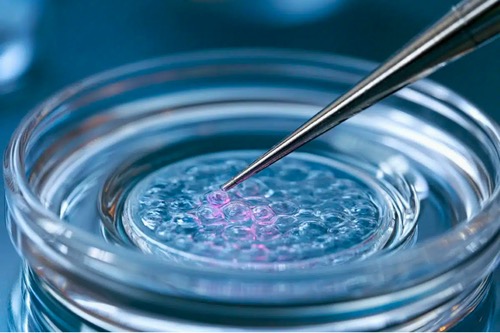 ‏World’s First Clinical Trial Using Embryonic Stem Cells to Treat Huntington’s Disease Launches