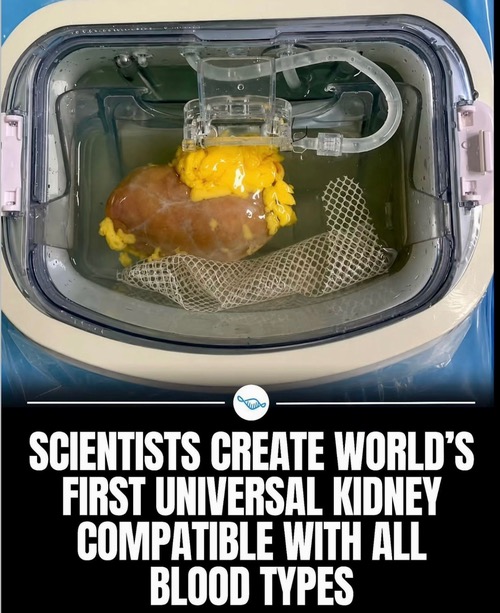 Universal kidney 